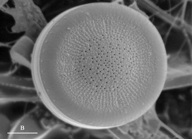 Resolution Limits Imposed by Spherical Aberration, Cs A diatom imaged using different working distances.