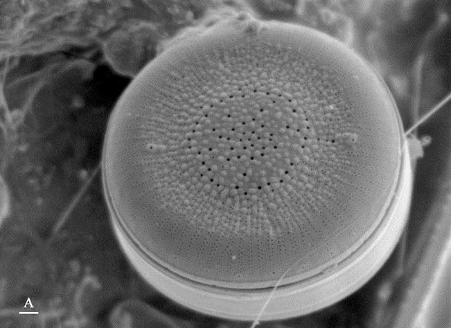 Fine detail of a diatom imaged at a low accelerating voltage of 5kV is visible (A).