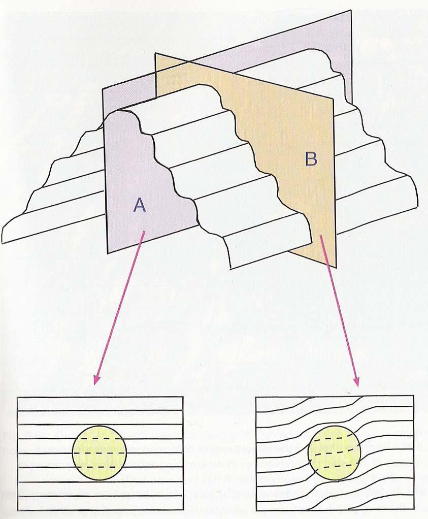 foliation. Figure 4 shows how a cut parallel to microfolding can look completely different than a cut that is perpendicular to fold direction. Fig. 4 shows how foliation and inclusions can look different depending on cut angle.