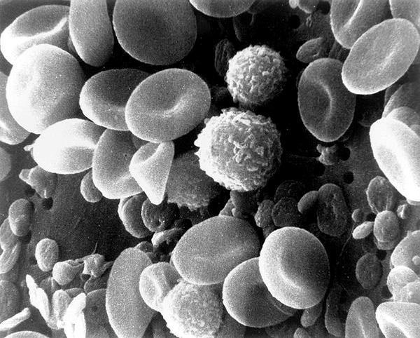 Typical SEM images Coloured image of soybean