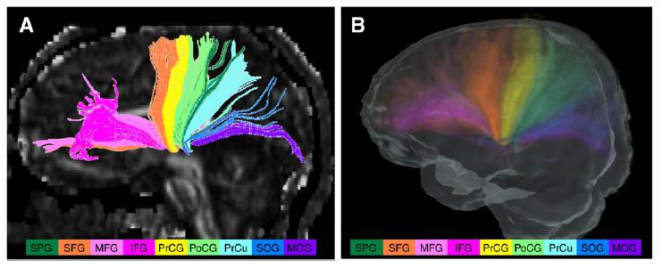 Sub-cortical hubs in the human brain: the thalamus! Zhang et al.