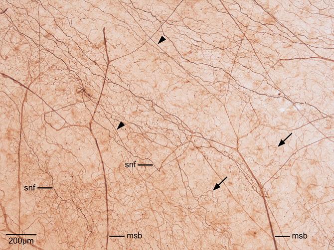 482 C.F. Marfurt et al. / Experimental Eye Research 90 (2010) 478e492 Fig. 8. Stromal free nerve endings (arrows). Fig. 6. Low magnification survey image of the peripheral corneal innervation.