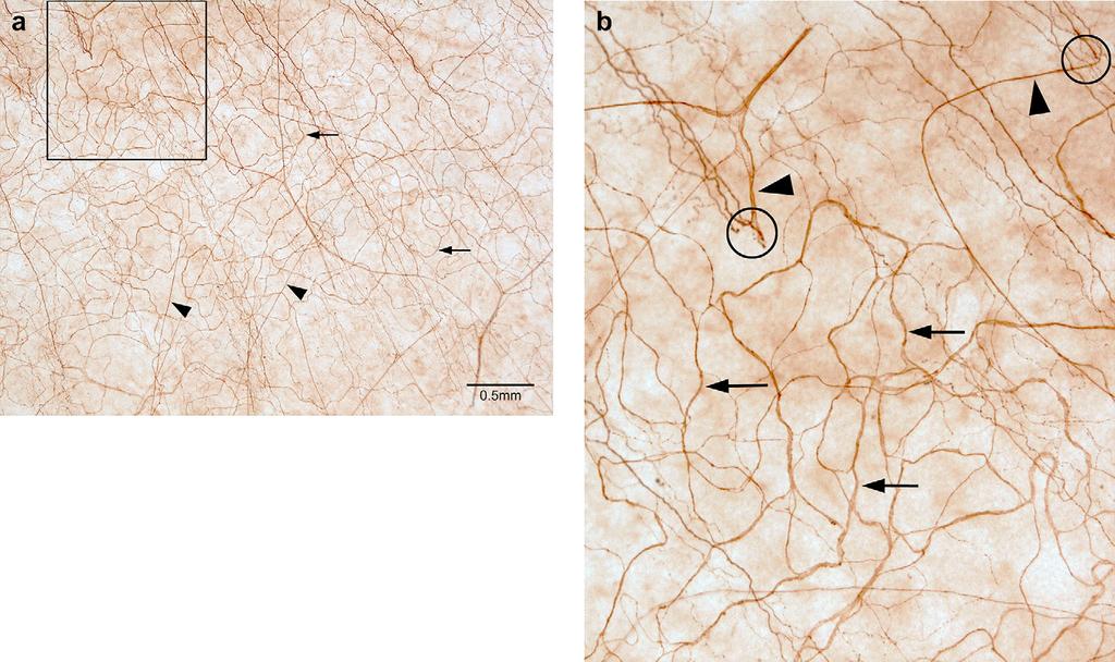 C.F. Marfurt et al. / Experimental Eye Research 90 (2010) 478e492 483 Fig. 9. a. Peripheral corneal innervation, focused on the subepithelial plexus.