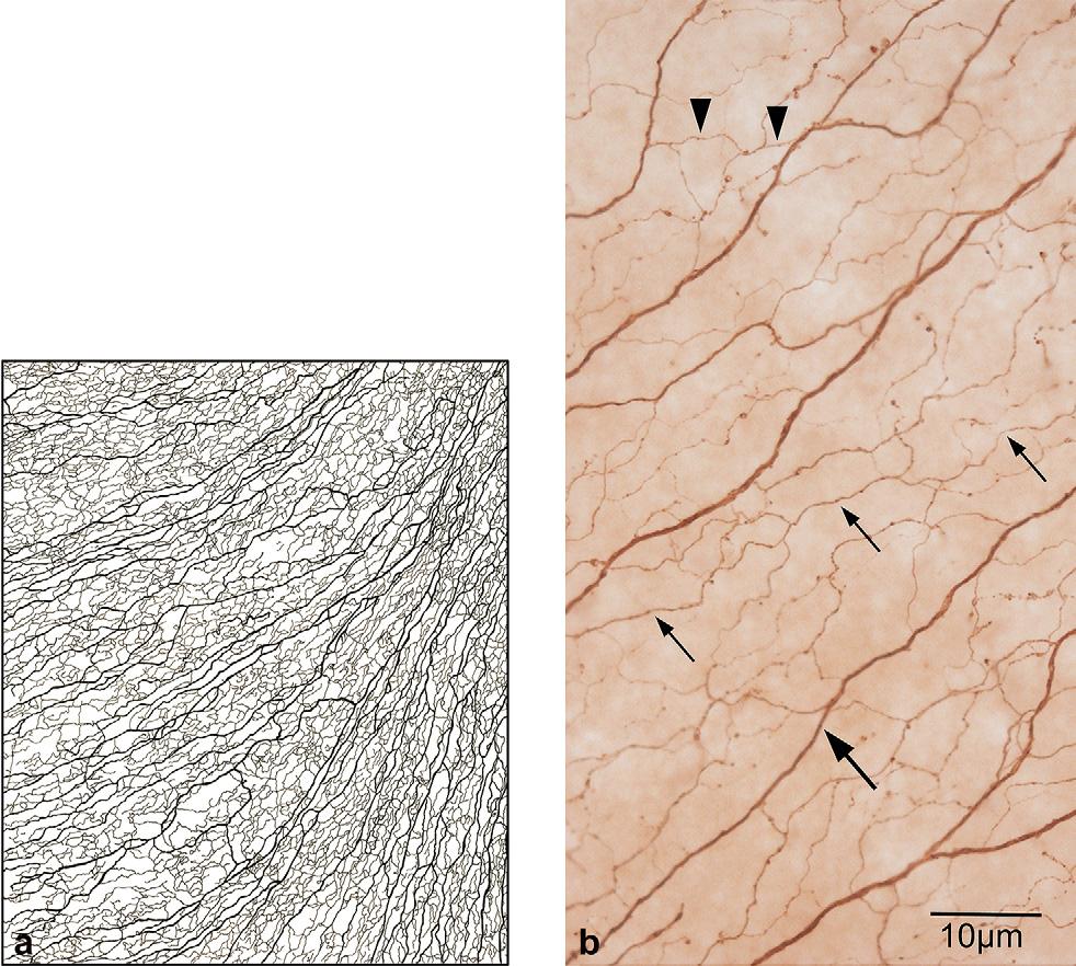 re b. b. Subbasal nerve fibers (e.g., arrows) travel roughly parallel to one another in the basal epithelial cell layer close to Bowman's membrane (bm).