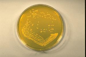 Staphylococcus aureus Describes the clustered arrangement of the cells (staphylo-) and the golden color of the colonies (aur-).