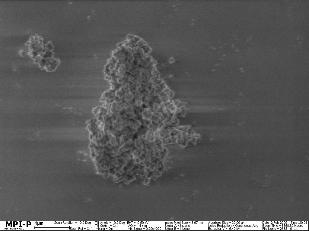Scanning electron micrograph of