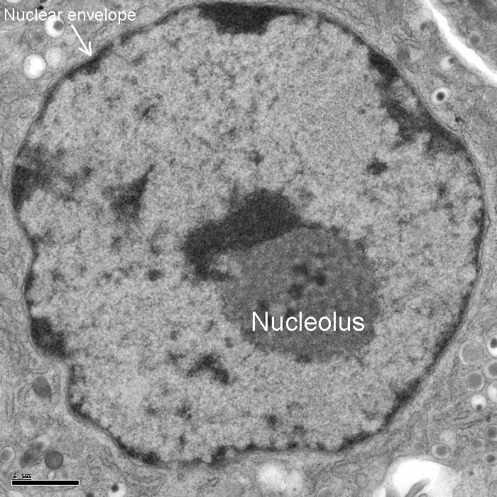 Eukaryotes: Structure Nucleolus Dense, irregularly shaped