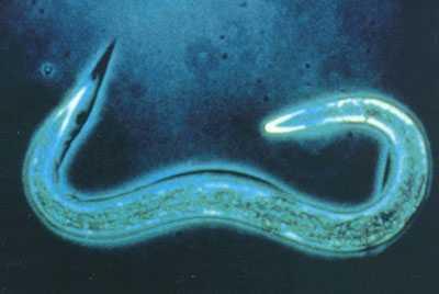 Nematoda - round worms Exoskeleton (molts) Unsegmented Psuedocoelom