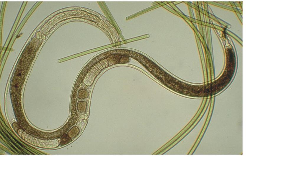 A freshwater nematode posterior end intestine anterior end ovary