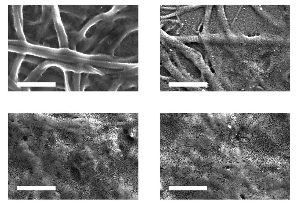 A B C D Fig.S2 The inhibitory effect of the CTBP peptide on collagen fibrils formation.