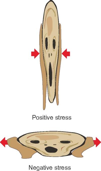 The Mohr Stress Diagram