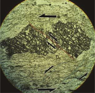 Also small scale, tight folding (D2) is observed, these folds affect the S1 foliation (figure 37b).