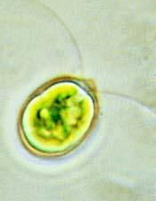 Green algae can be found in fresh and salt water, and in moist areas on land They can be: Unicellular Colonial