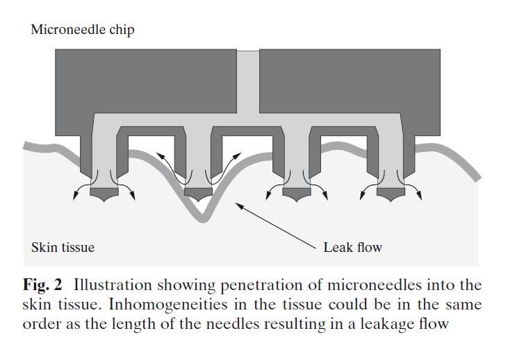 Design of an implantable active microport
