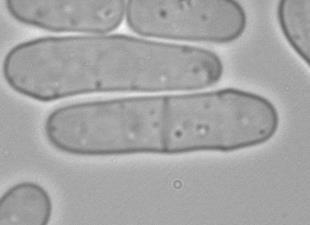 INTRODUCTORY INFO on FISSION YEAST CELL WALL and CELL SHAPE EM images BF image 1. Rod shape (capsule shape) with a thick cell wall, t=200nm. 2.