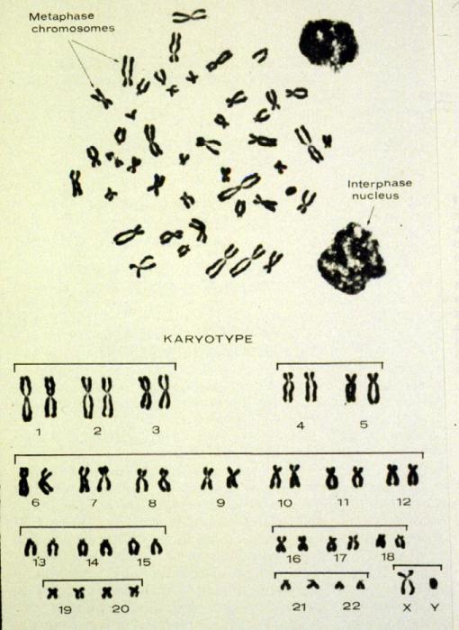 Chromosomes - rod-like organelles, visible during cell division Number of chromosomes Diploid - 2n -