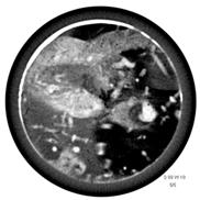 X-ray image 2.