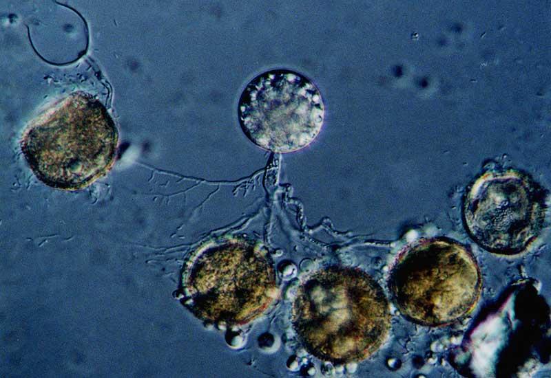 Division: Chytridiomycota Have Flagella (rare in fungi) Coenocytic hyphae or