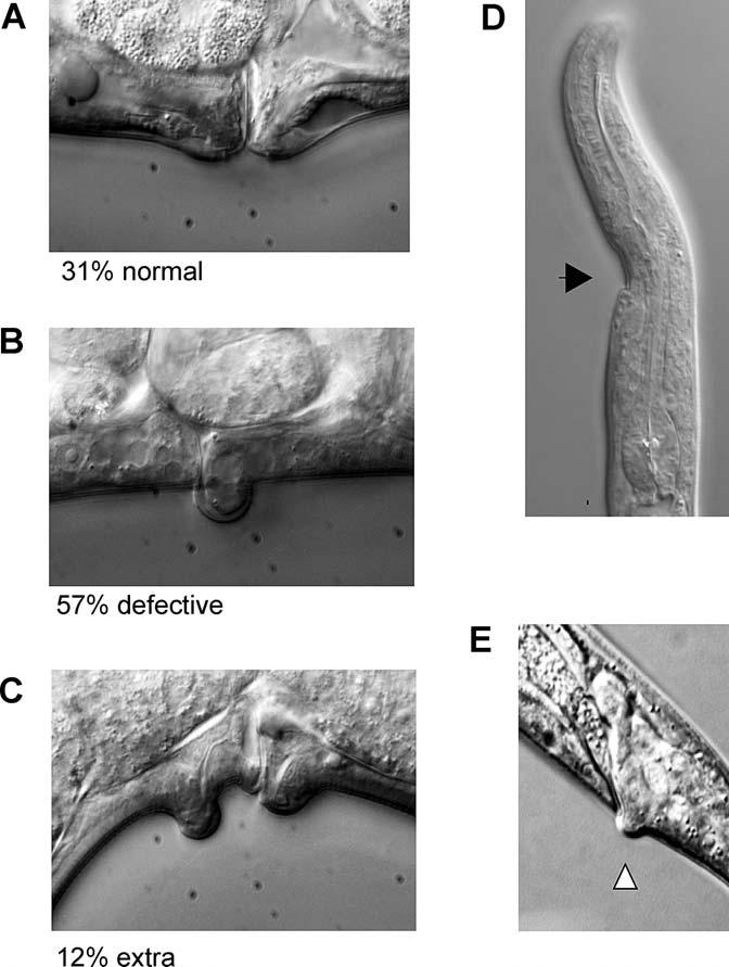 Figure 1. OSM-11 Is Required for Normal Development (A) Thirty-one percent of osm-11(lf) adult animals had overtly normal vulva and did not retain eggs resembling control animals.