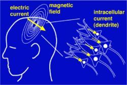 Electro/Magneto Encephalography Ions in the brain produce magnetic and electric fields