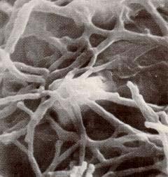 Hyphae of ectomycorrhizae do not invade root cells. Bacteria These single-celled prokaryotes are small (0.5-5.0 µm).