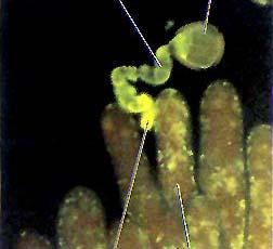 Sexual Incompatibility (Sporophytic or gametophytic) Genetic trait in which the