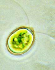 A) Unicellular Green Algae Very common in fresh