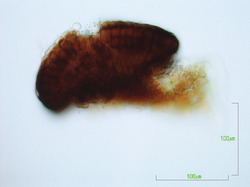 F. 1943. Dasturella: A New Genus of Uredinales. Mycologia 35:01 06. Widely prevalent fungi of the United States. http:// www.prevalentfungi.org/subject.cfm?id=56309 Mohanan, C. 1990.
