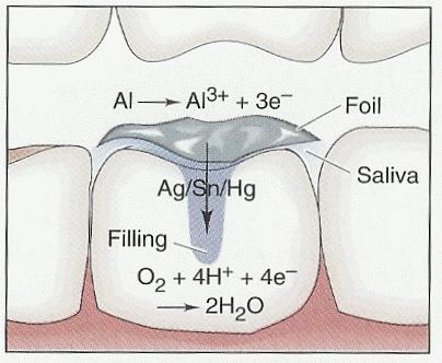ASIDE: Dentistry & Chemistry: The Pain of a Dental Voltaic Cell If one has an amalgam dental filling and accidentally bites down on a scrap of foil, they will feel a jolt of pain.