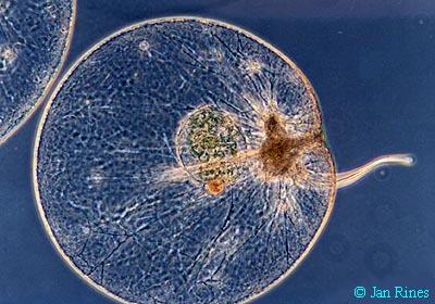 Red Tide Dinoflagellates Noctiluca scintillans, an anomalous heterotrophic red-tide