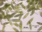 Protists: A diverse group Some are plantlike autotrophs like algae and kelp that are photosynthetic. They have a cell wall, chloroplasts and make their own food.
