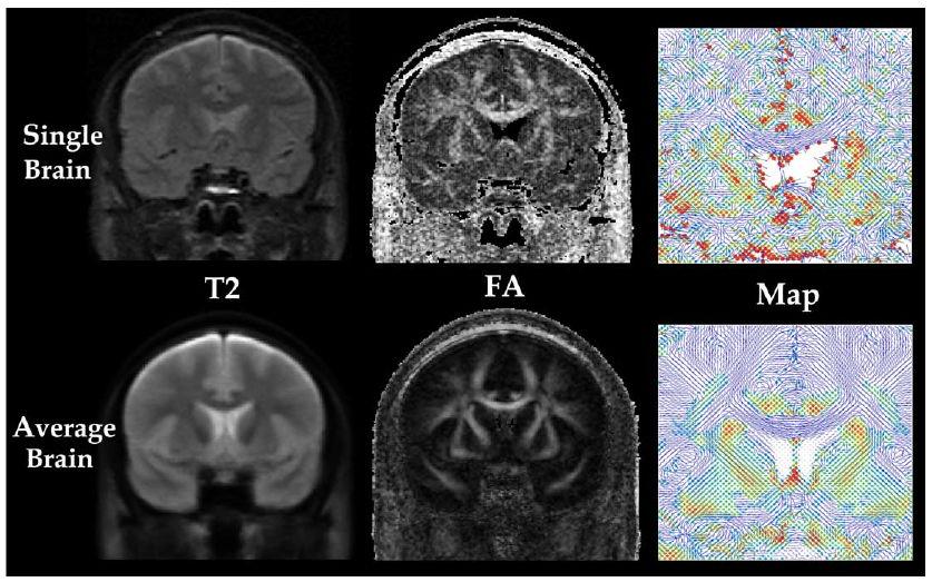 Park et al. Page 22 Fig. 4. DT-MRI of single brain and a group averaged brain (n = 15).