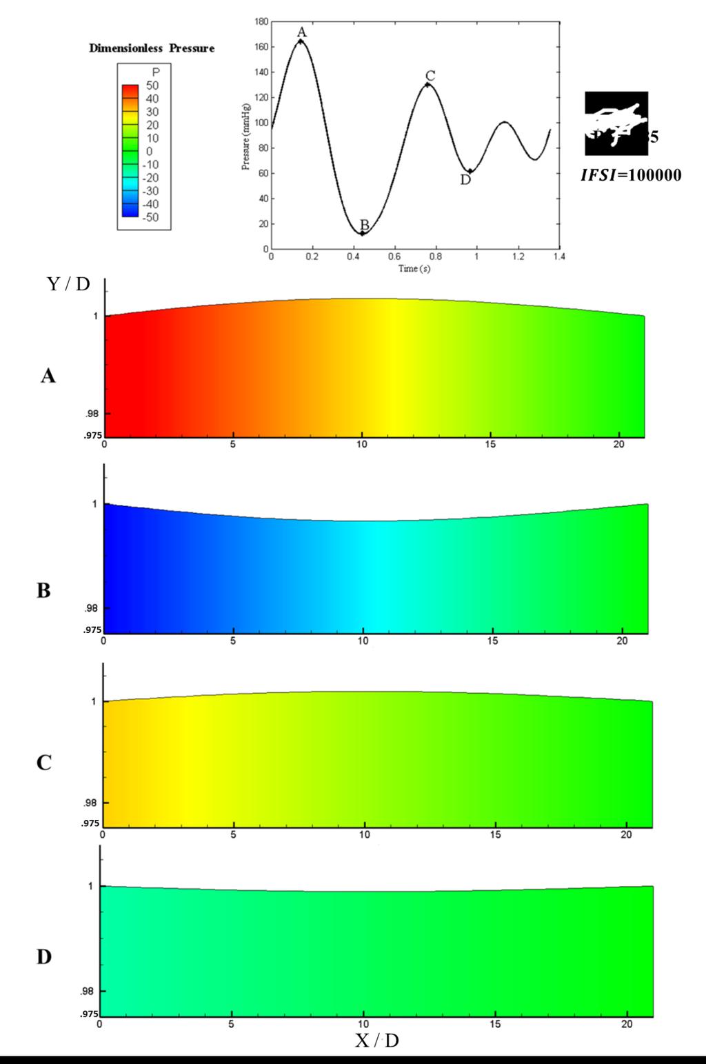 Figure 4-10: PBFEA Pressure field
