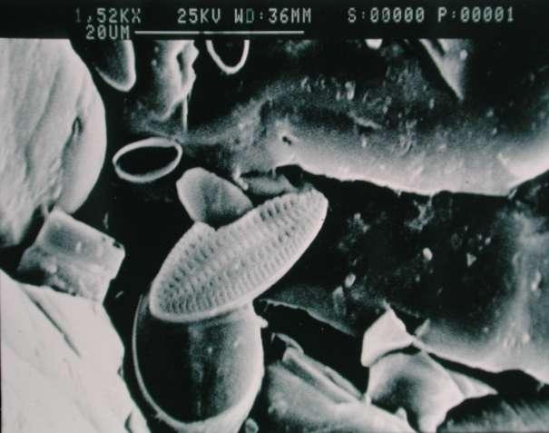 Diatoms on Marine