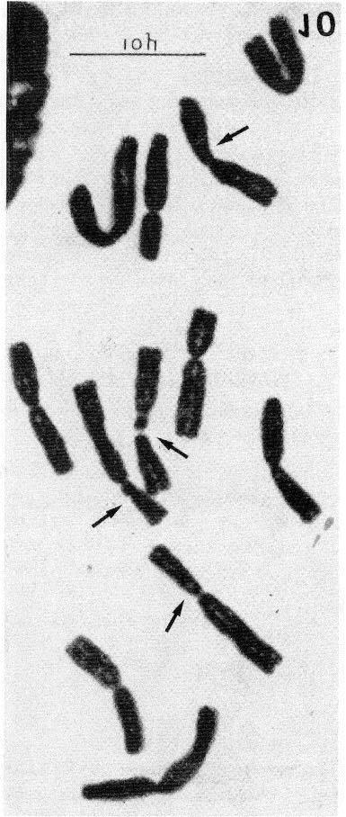 92 VOSA ICONOGRAPHY (Vosa, 1975, fig. 11, Plate IX, fig. 3); Plate IIC. CHROMOSOME NUMBERS 2n=2x=12 (karyotype AA, fig. 9).,- DISTRIBUTION North Eastern Transvaal. EXSICCATA TRANSVAAL.
