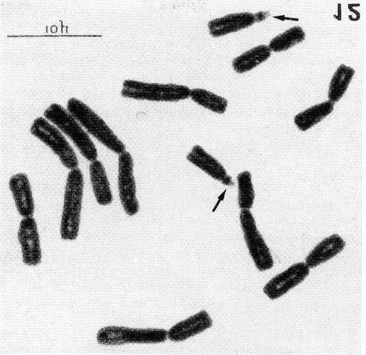 CYTOTAXONOMY OF THE GENUS TULBAGHIA 93 grans; Vosa, 1975 - Ann. Bot. (Rome), 34: 91, pi. XI, fig. 3, p. 93, fig. 13 (1975), as T.fragrans; Plate HE. CHROMOSOME NUMBERS 2n=2x=l2 (karyotype A, fig. 11).