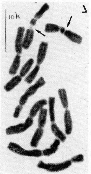ICONOGRAPHY (Vosa, 1975, fig. 8, Plate VI, fig. 3); Plate IF. CHROMOSOME NUMBERS 2n=2x=12 (karyotype A, fig. 6). DISTRIBUTION North Western Cape Province and Nabibia. EXSICCATA NABIBIA.