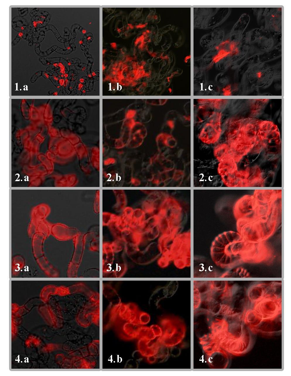 Figure 3: Extent of differentiation in cultured cells. Red colour shows the presence of secondary cell wall. 1.a,1.b,1.c: Control cells(uninduced) at 23h, 25h and 43h respectively. 2.a,2.
