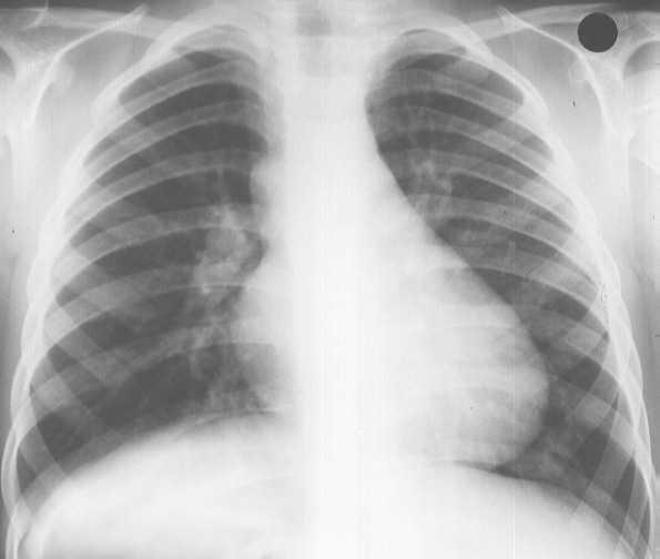 X rays How are X rays slides formed? X rays can penetrate soft tissue but not b.