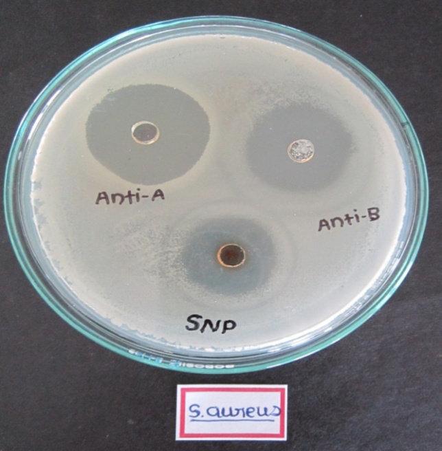 MICROORGANISMS Anti- A Anti- B Silver nanoparticles 1 Bacillus pumillus 12 mm 10.
