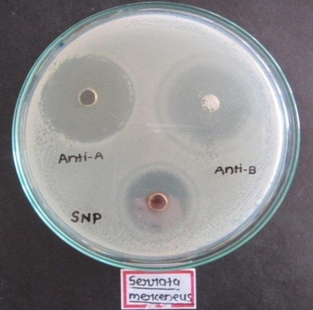 5 mm 14 mm 12 mm 4 Staphylococcus aureus 13 mm 10.