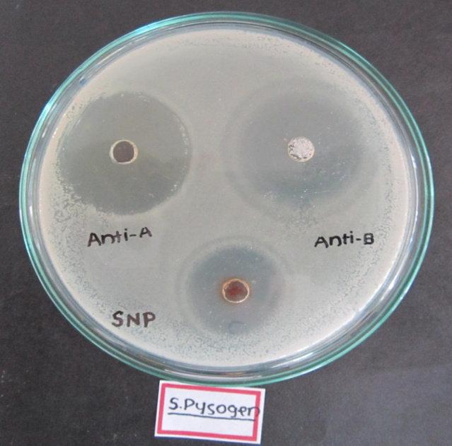Figure 13 Antibacterial activity of silver nanoparticles and antibiotics Bacillus pumillus Staphylococcus
