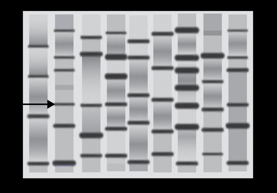 10 (b) DNA fragments can be separated using electrophoresis. Fig. 3.