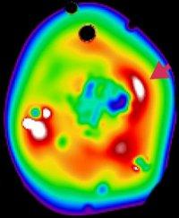 Accretion Shocks X-ray image of shock heated gas in a galaxy cluster.