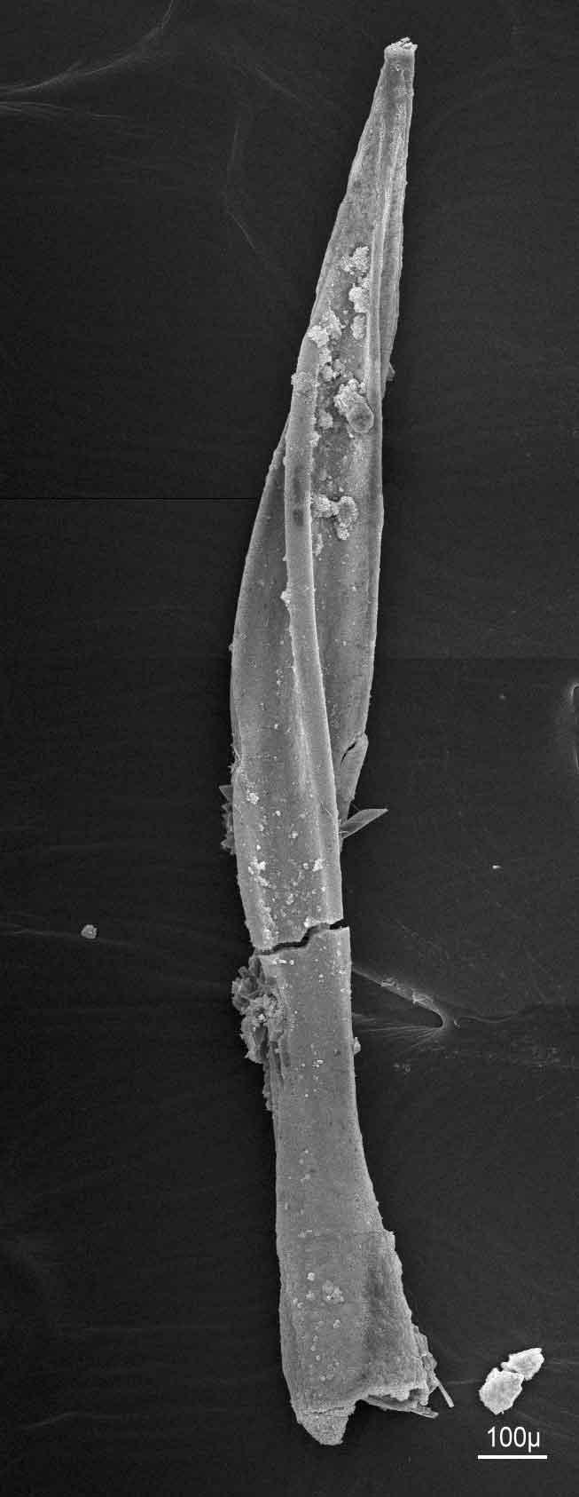 320 X. CUCHERAT & S. DEMUYNCK Figure 2 Pseudotrichia rubiginosa dart from Nieppe, River Lys (scale bar 100 µm).