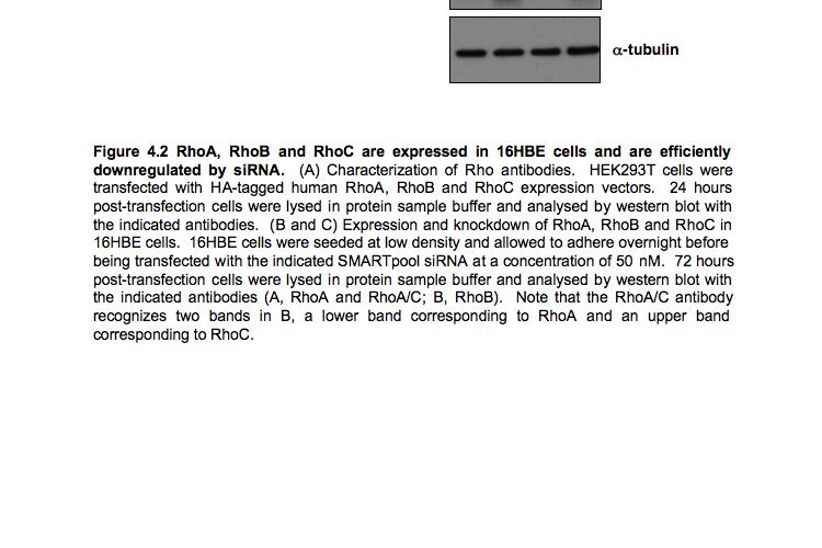An anti-rhoa/c antibody binds to both RhoA and RhoC, but has higher affinity for RhoC