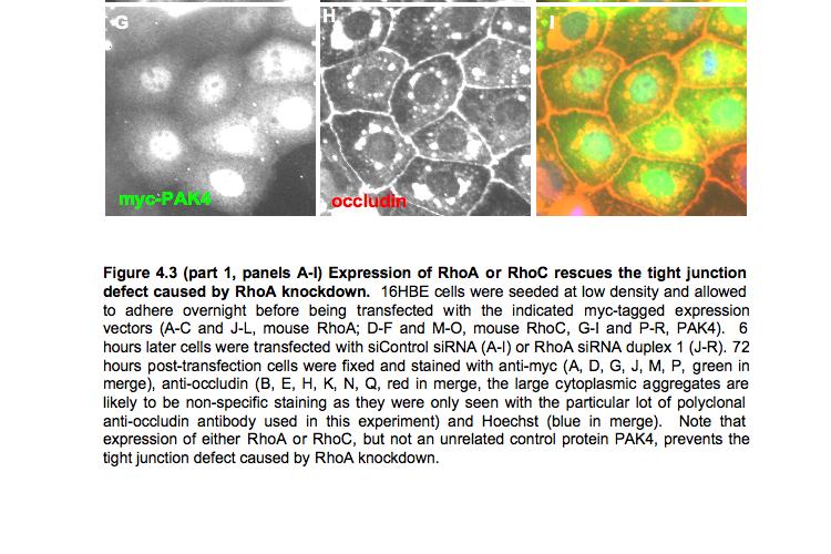by transfection of RhoA sirna duplexes is a specific consequence of loss of RhoA protein, and