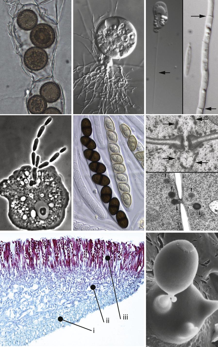 Magazine R843 Figure 2. Cellular structures of unicellular and multicellular fungi. (A) Rozella allomycis resistant sporangia formed inside hyphae of the host Allomyces sp. (Photomicrograph from T.Y.