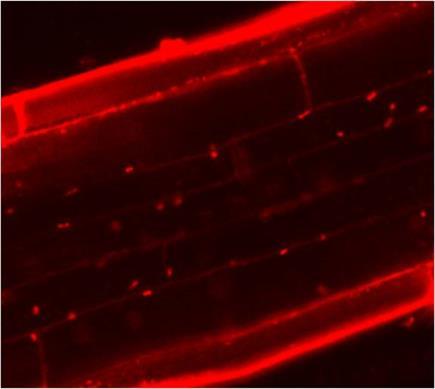 Confocal optical Z-sections of root tissues of 35S-FRO3-GFP plants co