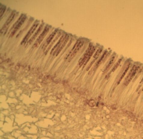 section through an ascocarp: hyphae, mycelium, hymenial layer, asci,
